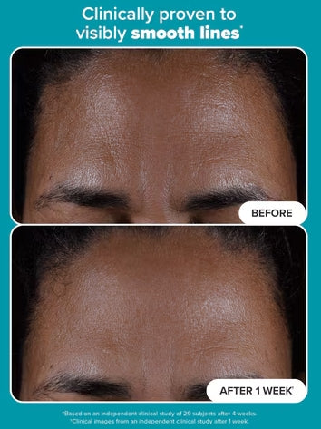 đĽLAST DAY 49% OFFâ¨ODEIUNâ˘- Skin Perfecting 2% BHA Liquid Exfoliant