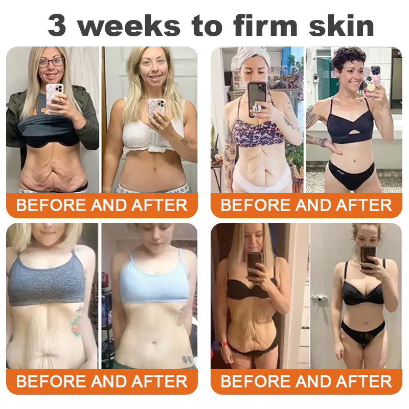 Made and Shipped from USA ✨ ODALIT™ Bee venom Comprehensive Cream 🔥 LAST DAY 80% OFF 💎💎