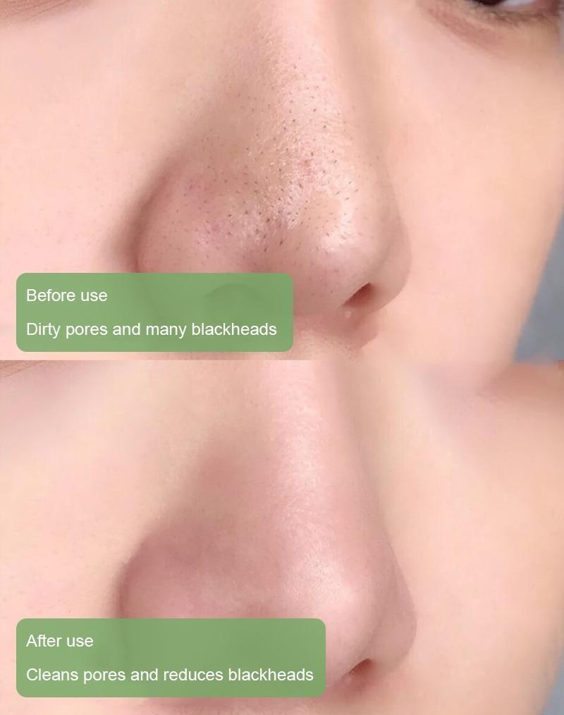 Diystar™  Green Tea Deep Cleanse Mask Stick