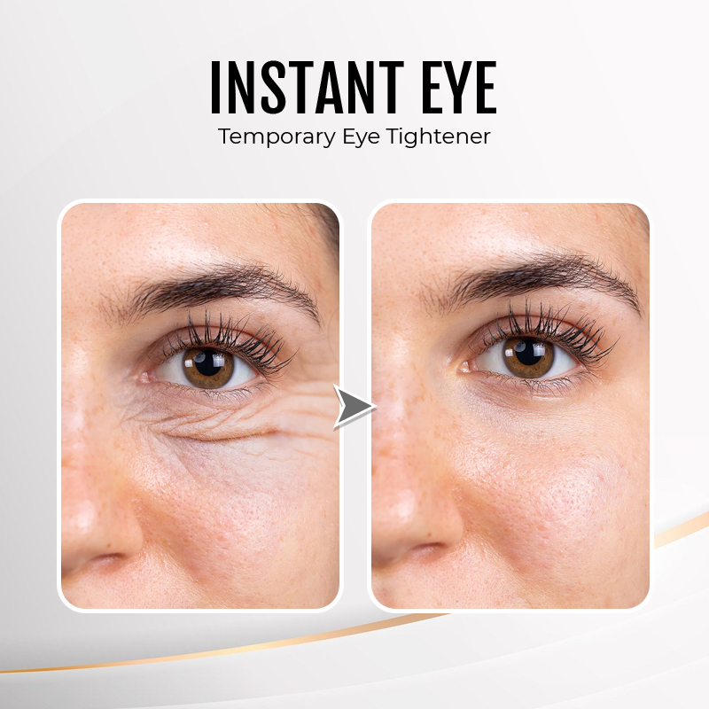 🔥 Last Day Discount: 88% OFF💐Instant Wrinkle Eye Tightener cream