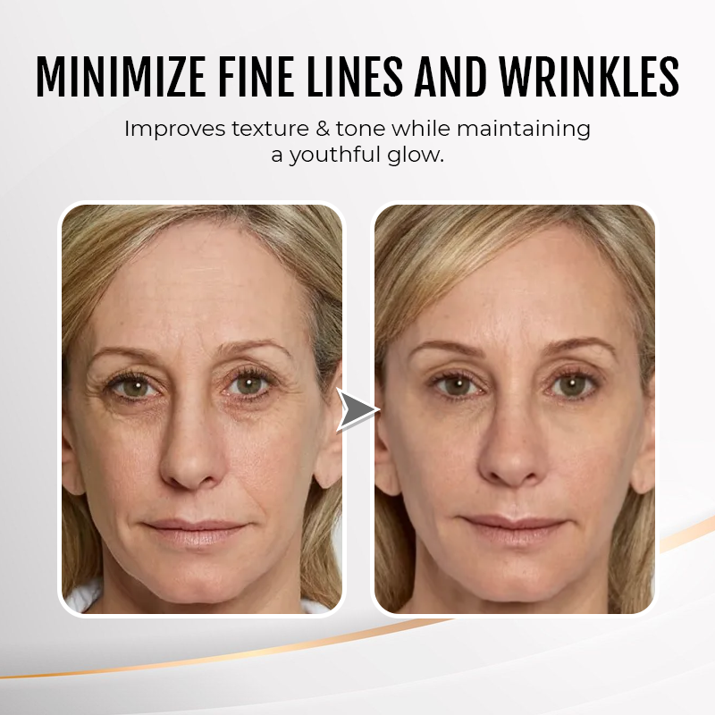 🔥 Last Day Discount: 88% OFF💐Instant Wrinkle Eye Tightener cream