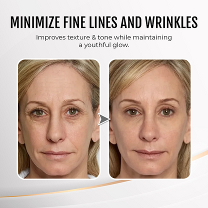 🔥 Last Day Discount: 88% OFF💐Instant Wrinkle Eye Tightener cream