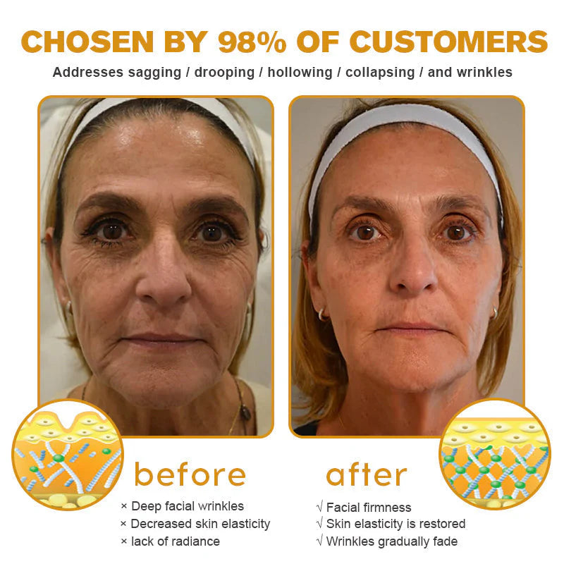 🎁Flash Sale - ODEIUN™ BOTOX Bee Venom Anti-Aging Serum - Suitable for all skin types🐝💎
