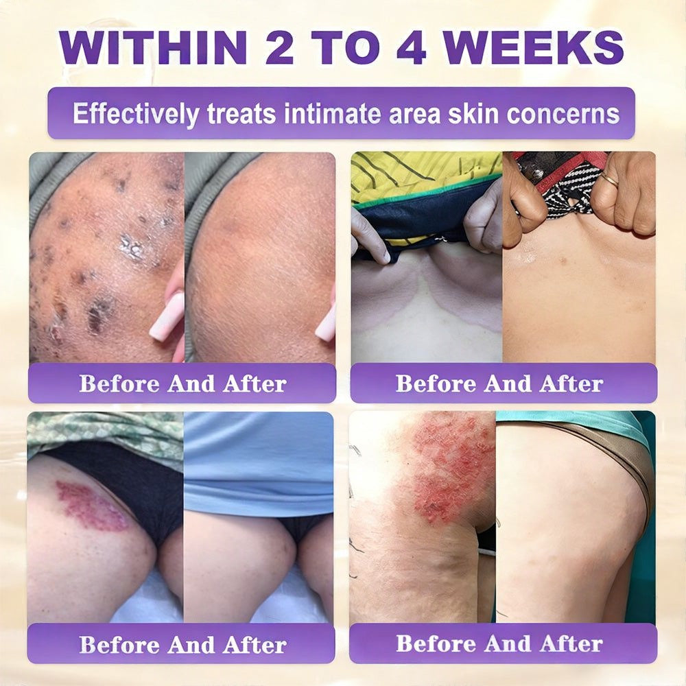 Made and Shipped from the US ODALIT® Biotin 10-in-1 Skin Repair Cream — Last Day of Sale: 75% Off