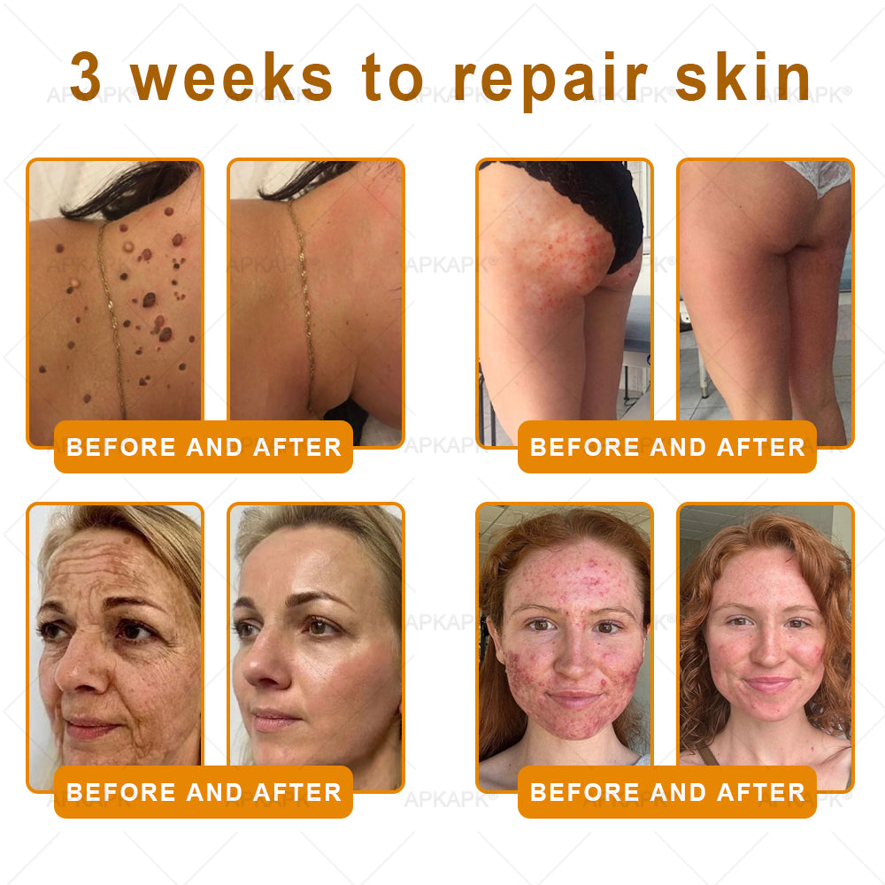 ODEIUN® 𝖡𝖾𝖾 𝗏𝖾𝗇𝗈𝗆 𝖲𝗄𝗂𝗇 𝖱𝖾𝗌𝗍𝗈𝗋𝖺𝗍𝗂𝗈𝗇 𝖢𝗋𝖾𝖺𝗆✨Made and Shipped from USA