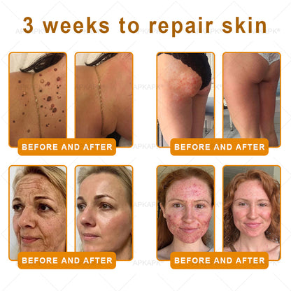 ODEIUN® 𝖡𝖾𝖾 𝗏𝖾𝗇𝗈𝗆 𝖲𝗄𝗂𝗇 𝖱𝖾𝗌𝗍𝗈𝗋𝖺𝗍𝗂𝗈𝗇 𝖢𝗋𝖾𝖺𝗆✨Made and Shipped from USA