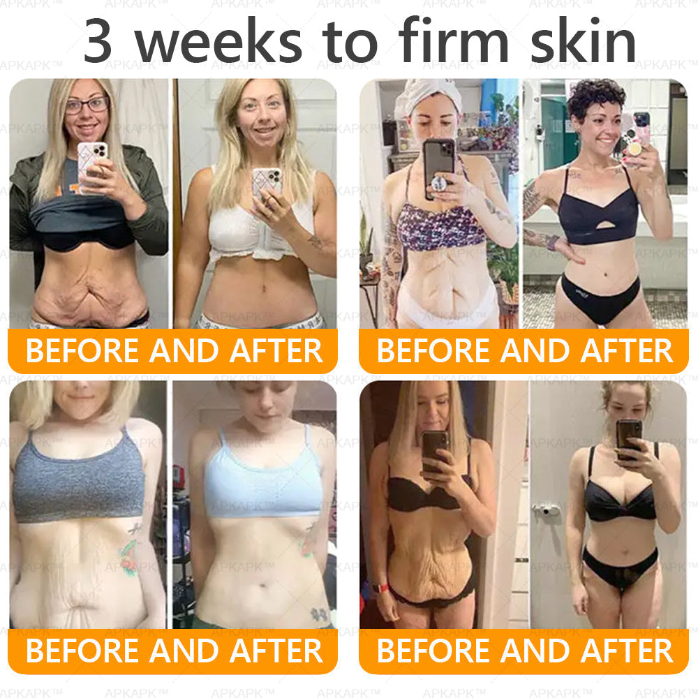 Made and Shipped from U.S. 🫧𝖠𝖯𝖪𝖠𝖯𝖪® 𝖡𝖾𝖾 𝗏𝖾𝗇𝗈𝗆 𝖲𝗄𝗂𝗇 𝖱𝖾𝗌𝗍𝗈𝗋𝖺𝗍𝗂𝗈𝗇 𝖢𝗋𝖾𝖺𝗆