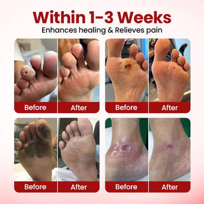 ODEIUN® VitaGluco Diabetic Care Cream