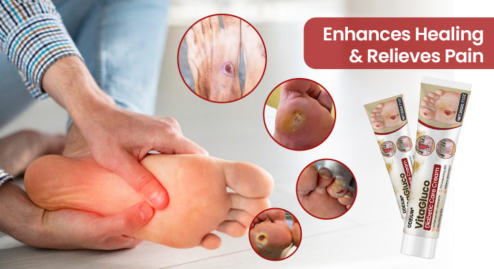 ODEIUN® VitaGluco Diabetic Care Cream