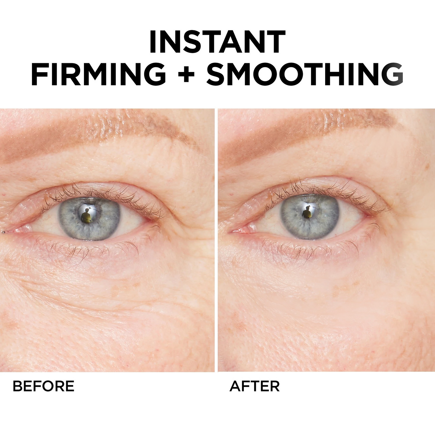 🔥 Last Day Discount: 88% OFF💐Instant Wrinkle Eye Tightener cream