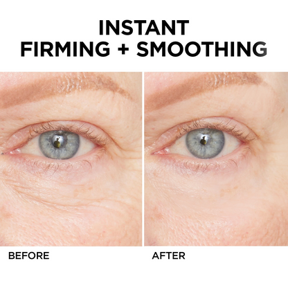 🔥 Last Day Discount: 88% OFF💐Instant Wrinkle Eye Tightener cream