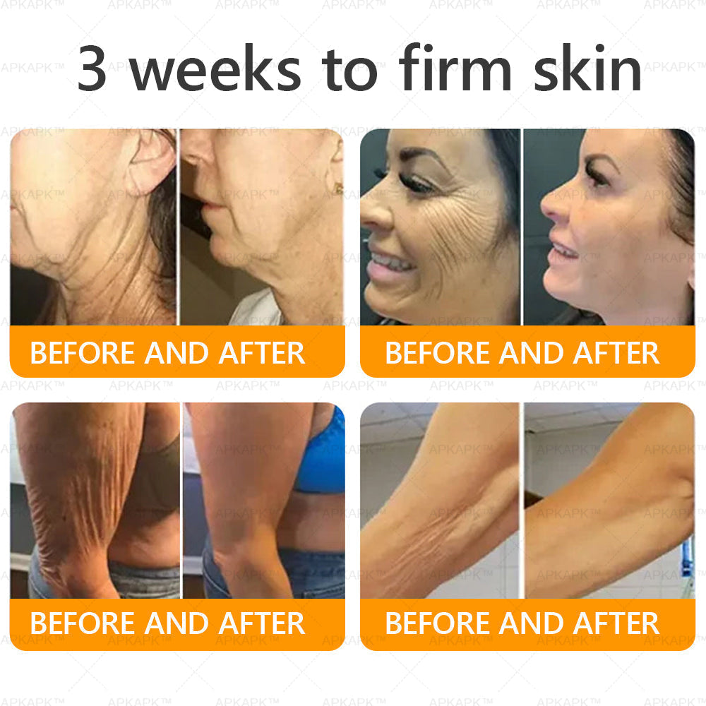 Made and Shipped from U.S. 🫧𝖠𝖯𝖪𝖠𝖯𝖪® 𝖡𝖾𝖾 𝗏𝖾𝗇𝗈𝗆 𝖲𝗄𝗂𝗇 𝖱𝖾𝗌𝗍𝗈𝗋𝖺𝗍𝗂𝗈𝗇 𝖢𝗋𝖾𝖺𝗆