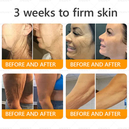 Made and Shipped from U.S. 🫧𝖠𝖯𝖪𝖠𝖯𝖪® 𝖡𝖾𝖾 𝗏𝖾𝗇𝗈𝗆 𝖲𝗄𝗂𝗇 𝖱𝖾𝗌𝗍𝗈𝗋𝖺𝗍𝗂𝗈𝗇 𝖢𝗋𝖾𝖺𝗆