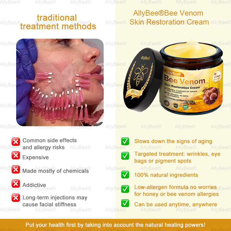 【Official Shop】 AllyBee® Skin Treatment Cream Anti-aging, Hydrating, Skin Repair, Even Tone, Acne and Dark Spot Treatment, Wart and Mole Removal, Psoriasis Relief
