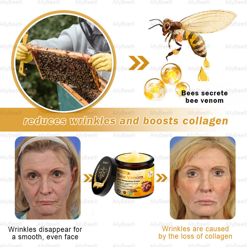 【Official Shop】 AllyBee® Skin Treatment Cream Anti-aging, Hydrating, Skin Repair, Even Tone, Acne and Dark Spot Treatment, Wart and Mole Removal, Psoriasis Relief