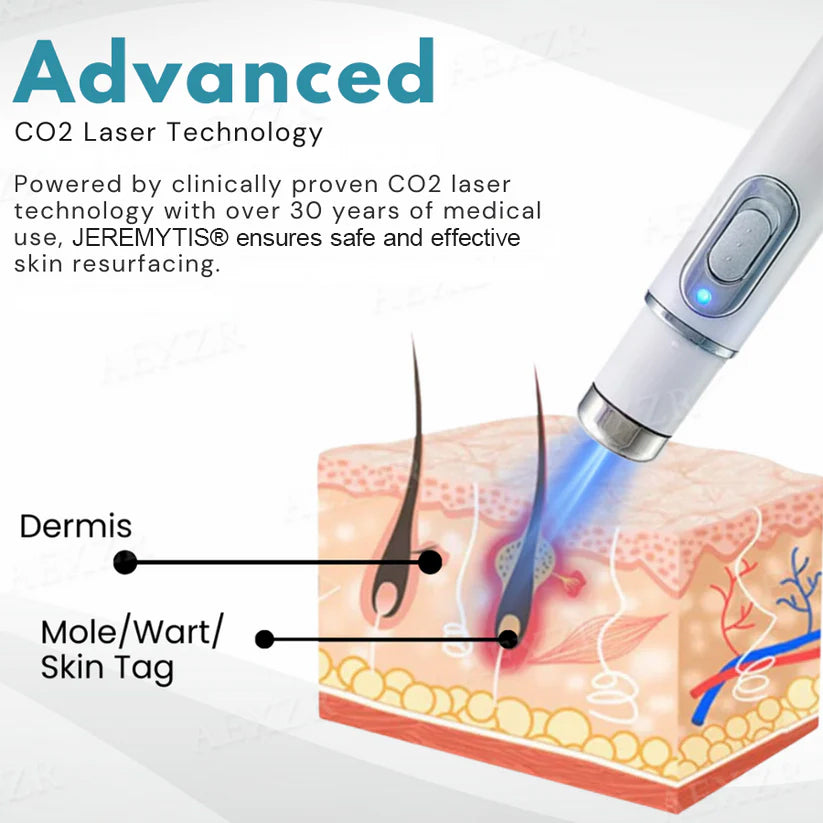 JEREMYTIS® Non-Invasive Mole and Wart Removal Laser Pen