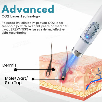 JEREMYTIS® Non-Invasive Mole and Wart Removal Laser Pen