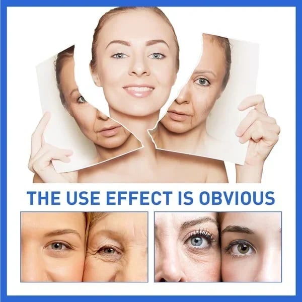 🔥Last Day Promotion 70% OFF🔥-Botox Face Serum