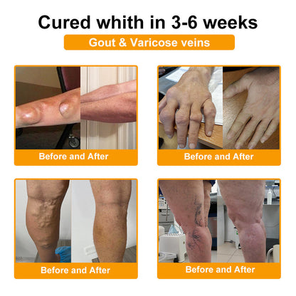 🎁Flash Sale - ODALIT™ Botulinum Toxin & Bee Venom Pain-Relief Bone Healing Cream