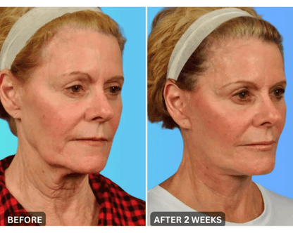 🔥Last Day 79% Off JEREMYTIS™ Skin Firming Beauty Meter