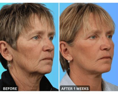 🔥Last Day 79% Off JEREMYTIS™ Skin Firming Beauty Meter