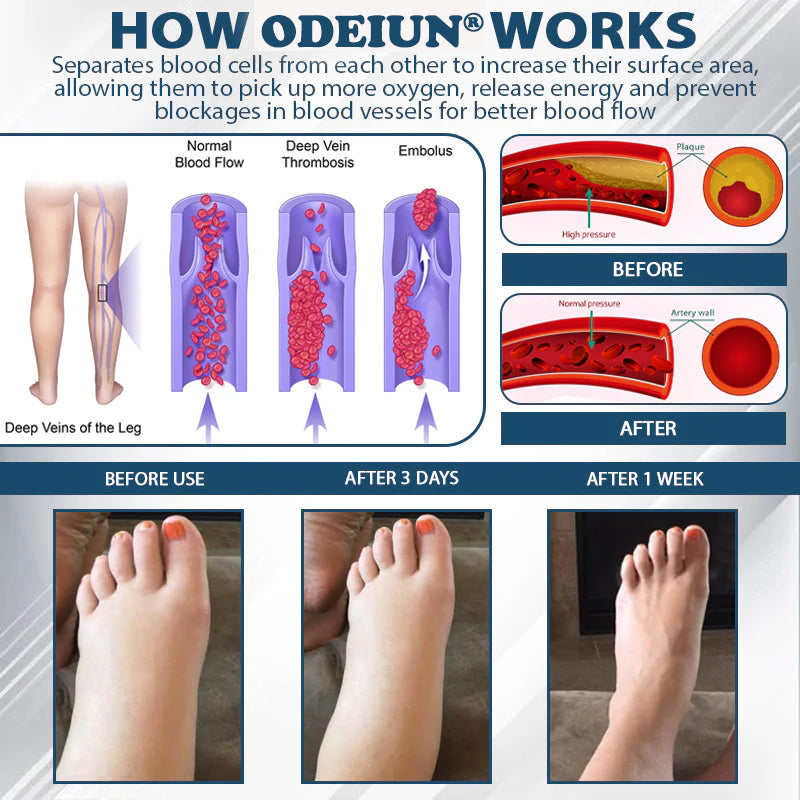 ODEIUN® Black Cumin Edema Detox Herbal Cream