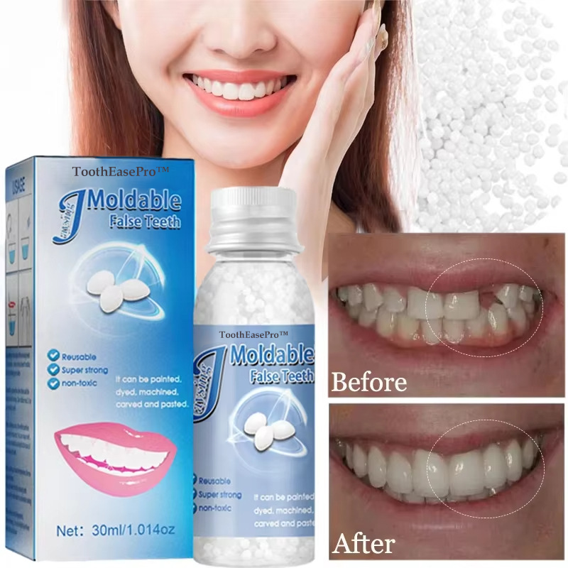 🦷 ToothEasePro™ Dental Filling Gel – Pain-Free, Drill-Free Cavity Solution💖💖