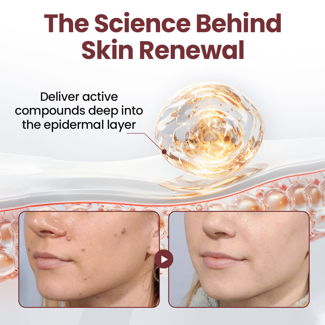 Seurico®KeraErase Dual-Action Renewal Cream