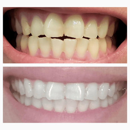 Magic Whitening Toothpaste JEREMYTIS™  Powder with Hydroxyapatite - World's First & Only! Sprinkle or Dip!