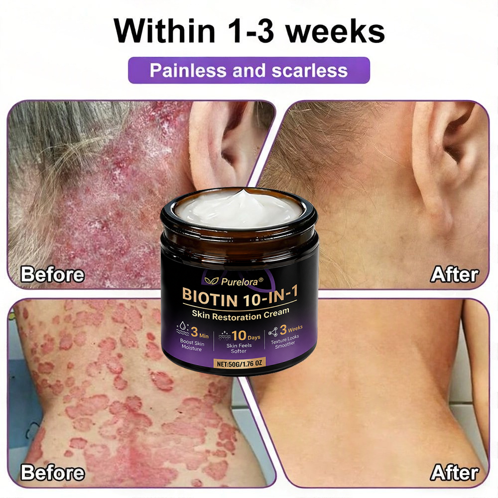 Made and Shipped from the US ODALIT® Biotin 10-in-1 Skin Repair Cream — Last Day of Sale: 75% Off