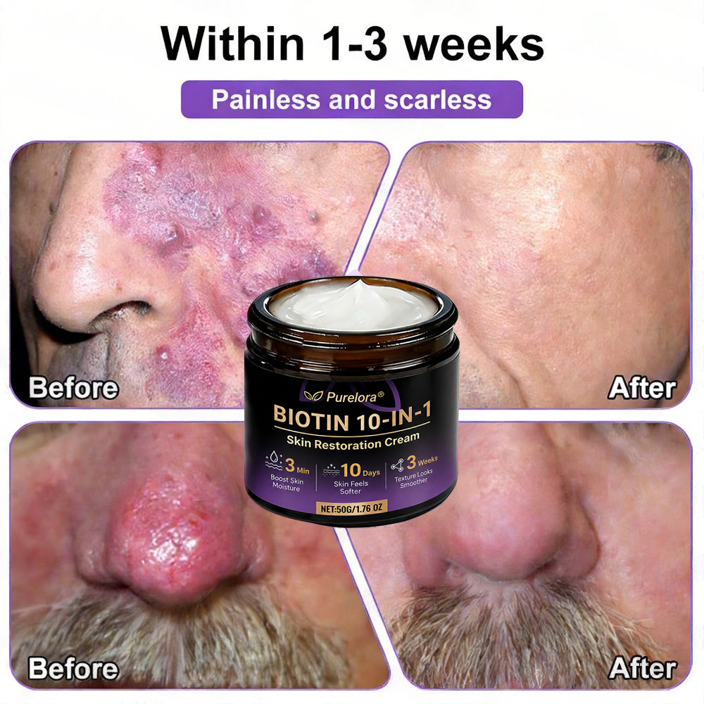 Made and Shipped from the US ODALIT® Biotin 10-in-1 Skin Repair Cream — Last Day of Sale: 75% Off