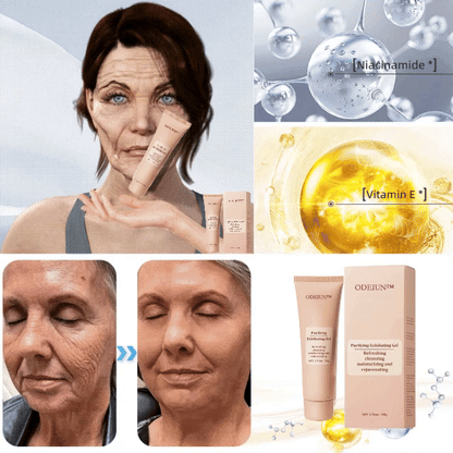 ODEIUN™ Purifying Exfoliating Gel for Acanthosis Nigricans, Exfoliation, Dark Spots, Skin Tags, and Eczema