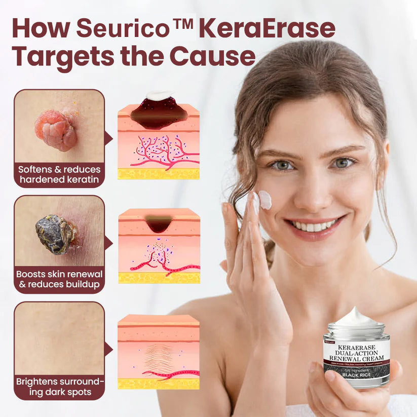 Seurico®KeraErase Dual-Action Renewal Cream