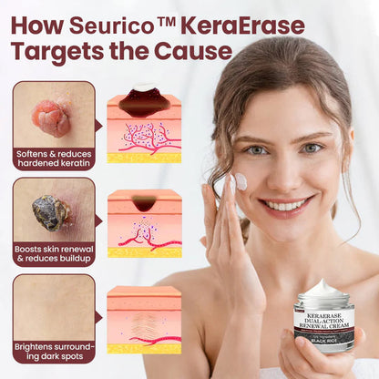 Seurico®KeraErase Dual-Action Renewal Cream