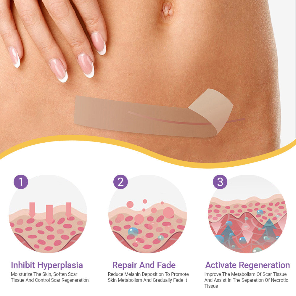 ✅Official Store |NEGUSY® Hyaluronic Acid Nano Microneedle Repair Tape🏉❤️