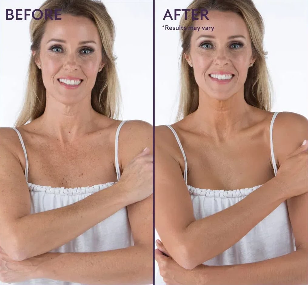 🎁Last Day - Buy 1 Get 1 Free🎉All-in-one Moisturizer, Concealer & Coverage 💧✨ Lightweight & Waterproof