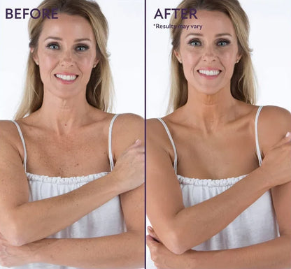 🎁Last Day - Buy 1 Get 1 Free🎉All-in-one Moisturizer, Concealer & Coverage 💧✨ Lightweight & Waterproof