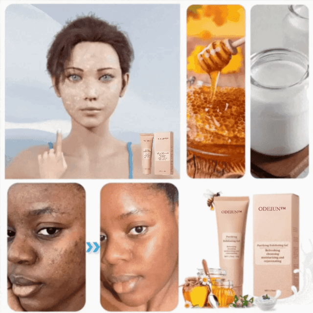 ODEIUN™ Purifying Exfoliating Gel for Acanthosis Nigricans, Exfoliation, Dark Spots, Skin Tags, and Eczema