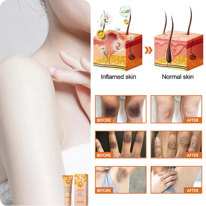 ODEIUN™ Purifying Exfoliating Gel for Acanthosis Nigricans, Exfoliation, Dark Spots, Skin Tags, and Eczema