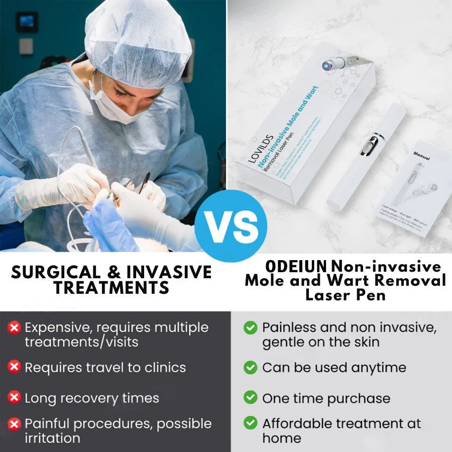 🔥【OFFICIAL STORE】ODEIUN™ Non-Invasive Mole and Wart Removal Laser Pen