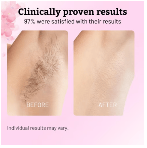 🔥Last Day 49% OFF ✨Cyperus Rotundus Oil