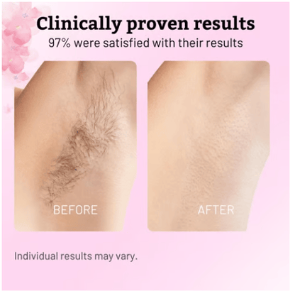 🔥Last Day 49% OFF ✨Cyperus Rotundus Oil