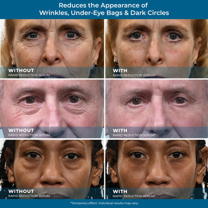 🌟 Prexdren®  Rapid Reduction Eye Serum — Instantly reduces eye bags, wrinkles, and dark circles