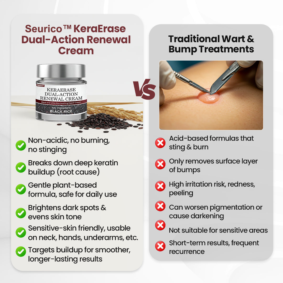 Seurico®KeraErase Dual-Action Renewal Cream