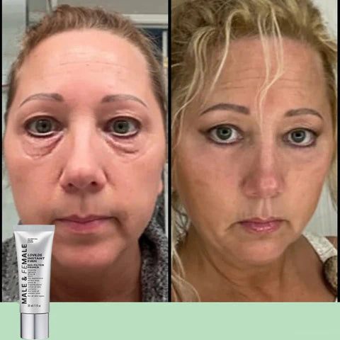 🔥Last Day 49% OFF🔥 Instant Eye Lift Firming Cream💕