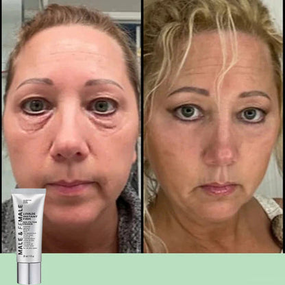 🔥Last Day 49% OFF🔥 Instant Eye Lift Firming Cream💕