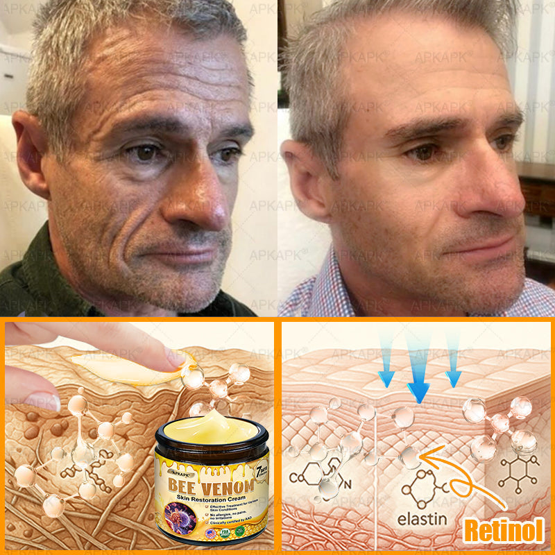 Made and Shipped from U.S. 🫧𝖠𝖯𝖪𝖠𝖯𝖪® 𝖡𝖾𝖾 𝗏𝖾𝗇𝗈𝗆 𝖲𝗄𝗂𝗇 𝖱𝖾𝗌𝗍𝗈𝗋𝖺𝗍𝗂𝗈𝗇 𝖢𝗋𝖾𝖺𝗆