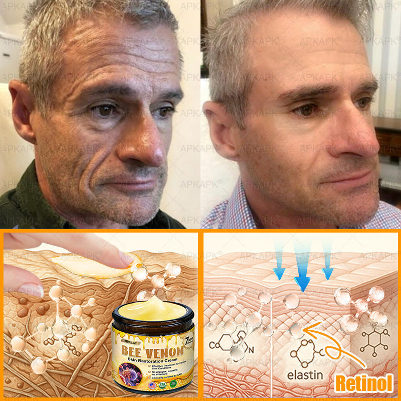 ODEIUN® 𝖡𝖾𝖾 𝗏𝖾𝗇𝗈𝗆 𝖲𝗄𝗂𝗇 𝖱𝖾𝗌𝗍𝗈𝗋𝖺𝗍𝗂𝗈𝗇 𝖢𝗋𝖾𝖺𝗆✨Made and Shipped from USA