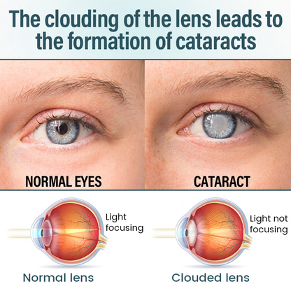 🔥Timilk® OptiFusion Nano Eye Drops Serum —Nano Technology Restores Clear Vision,  No Glasses, No Surgery