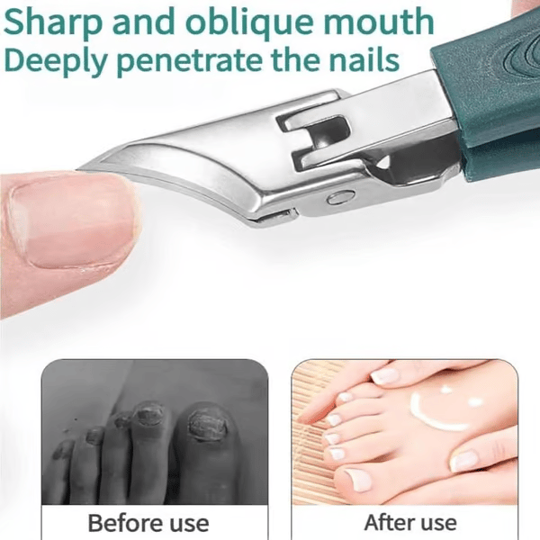🔥Last Day Sale 49% OFF - Eagle Beak Angled Nail Clippers 3-Piece Set